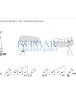 ESQUEMA-PUNTA-GK2-KAVO-SONICFLEX-NKS-TI-MAX-WOODPECKER-28-GK2-MARCA