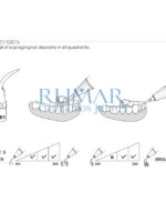 ESQUEMA-PUNTA-G1-EMS-COMPATIBLES-WOODPECKER-28-G1-MARCA