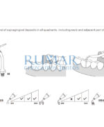 ESQUEMA-PUNTA-A2-AMDENT-COMPATIBLES-WOODPECKER-28-A2-MARCA