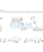 ESQUEMA-PUNTA-G10-EMS-COMPATIBLES-WOODPECKER-28-G10-MARCA