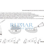 ESQUEMA-PUNTA-PD90-SATELEC-COMPATIBLES-WOODPECKER-28-PD90-MARCA