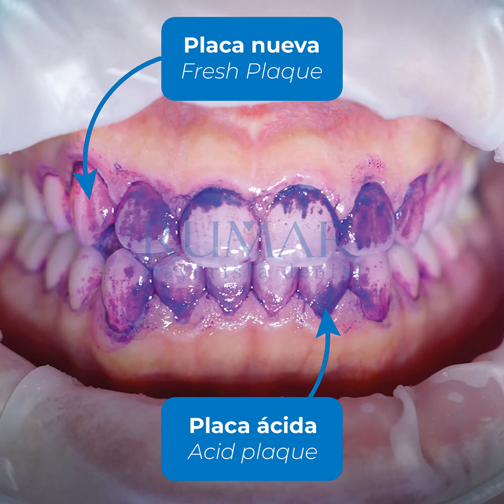 REVELADOR-BIOFILM-DISCLOSER-P-28-BIORP-MARCA-2